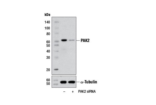  Image 1: SignalSilence® PAK2 siRNA I (Mouse Specific)