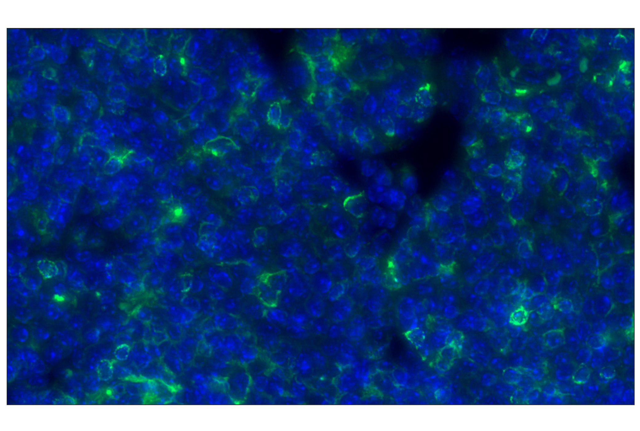 Immunohistochemistry Image 1: CD11c (D1V9Y) Rabbit mAb (Alexa Fluor® 488 Conjugate)