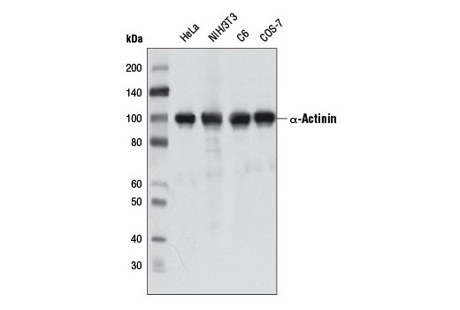  Image 7: Focal Adhesion Protein Antibody Sampler Kit