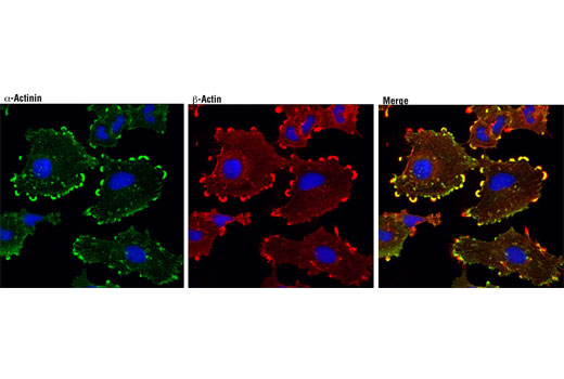 Immunofluorescence Image 1: α-Actinin (D6F6) XP® Rabbit mAb