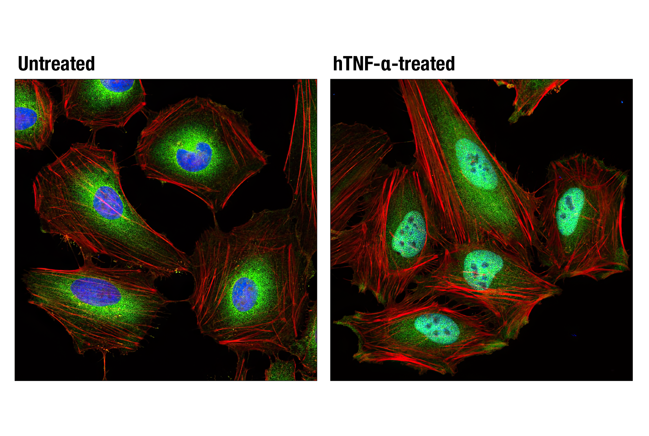 Immunofluorescence Image 1: NF-κB p65 (L8F6) Mouse mAb (BSA and Azide Free)