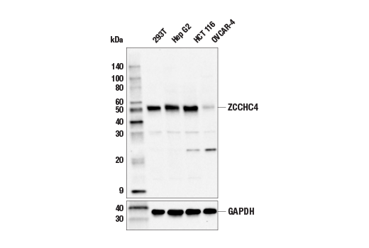 Western Blotting Image 1: ZCCHC4 Antibody