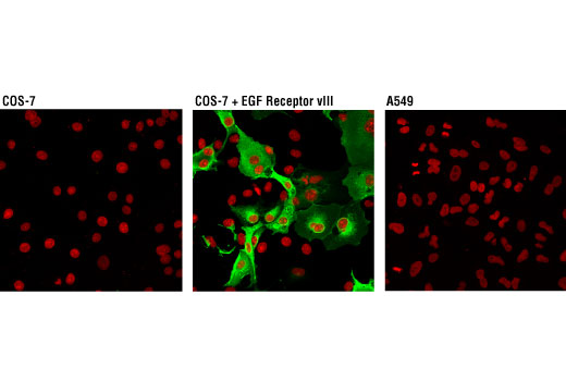 Immunofluorescence Image 1: EGF Receptor vIII (D6T2Q) XP® Rabbit mAb