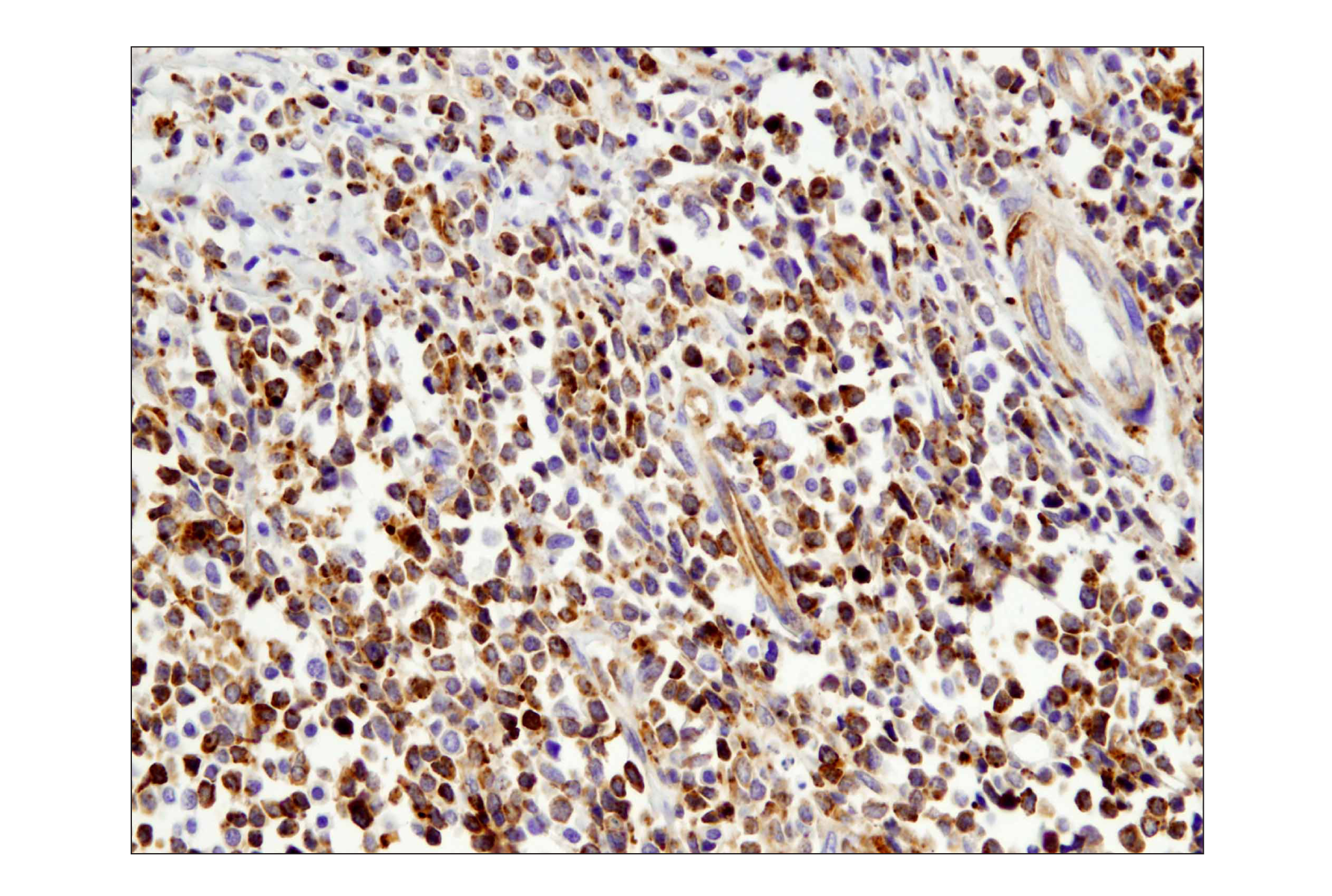  Image 37: Human T Cell Co-inhibitory and Co-stimulatory Receptor IHC Antibody Sampler Kit