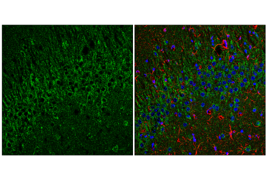 Immunofluorescence Image 3: EEA1 (C45B10) Rabbit mAb (BSA and Azide Free)