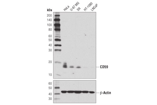 Western Blotting Image 1: CD59 Antibody