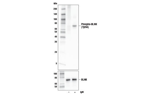 Western Blotting Image 1: Phospho-BLNK (Tyr84) Antibody
