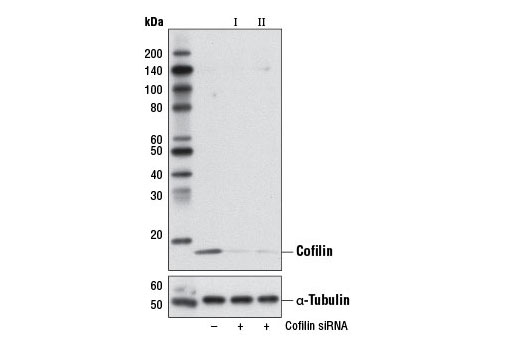  Image 1: SignalSilence® Cofilin siRNA II (Mouse Specific)