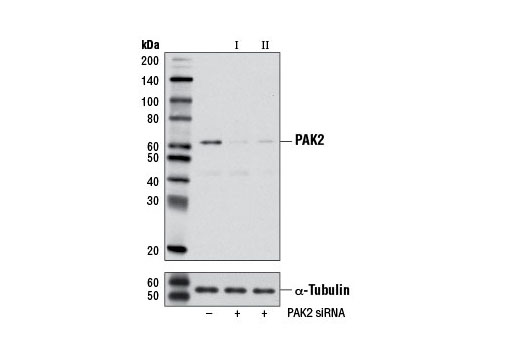  Image 1: SignalSilence® PAK2 siRNA II