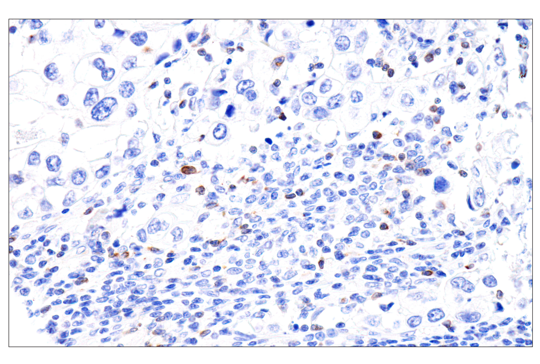 Immunohistochemistry Image 2: Perforin (IHC646) Mouse mAb
