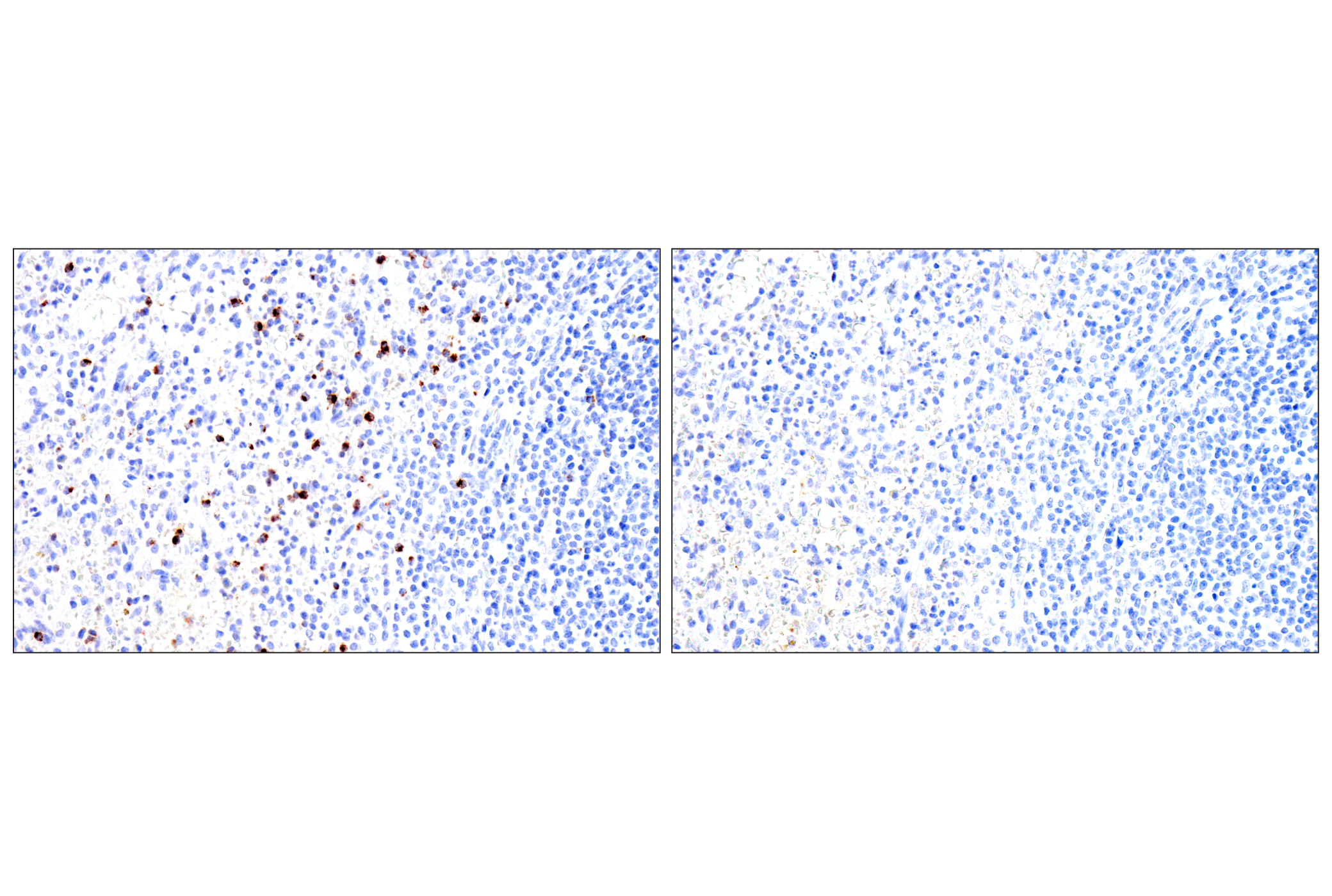 Immunohistochemistry Image 7: Perforin (IHC646) Mouse mAb