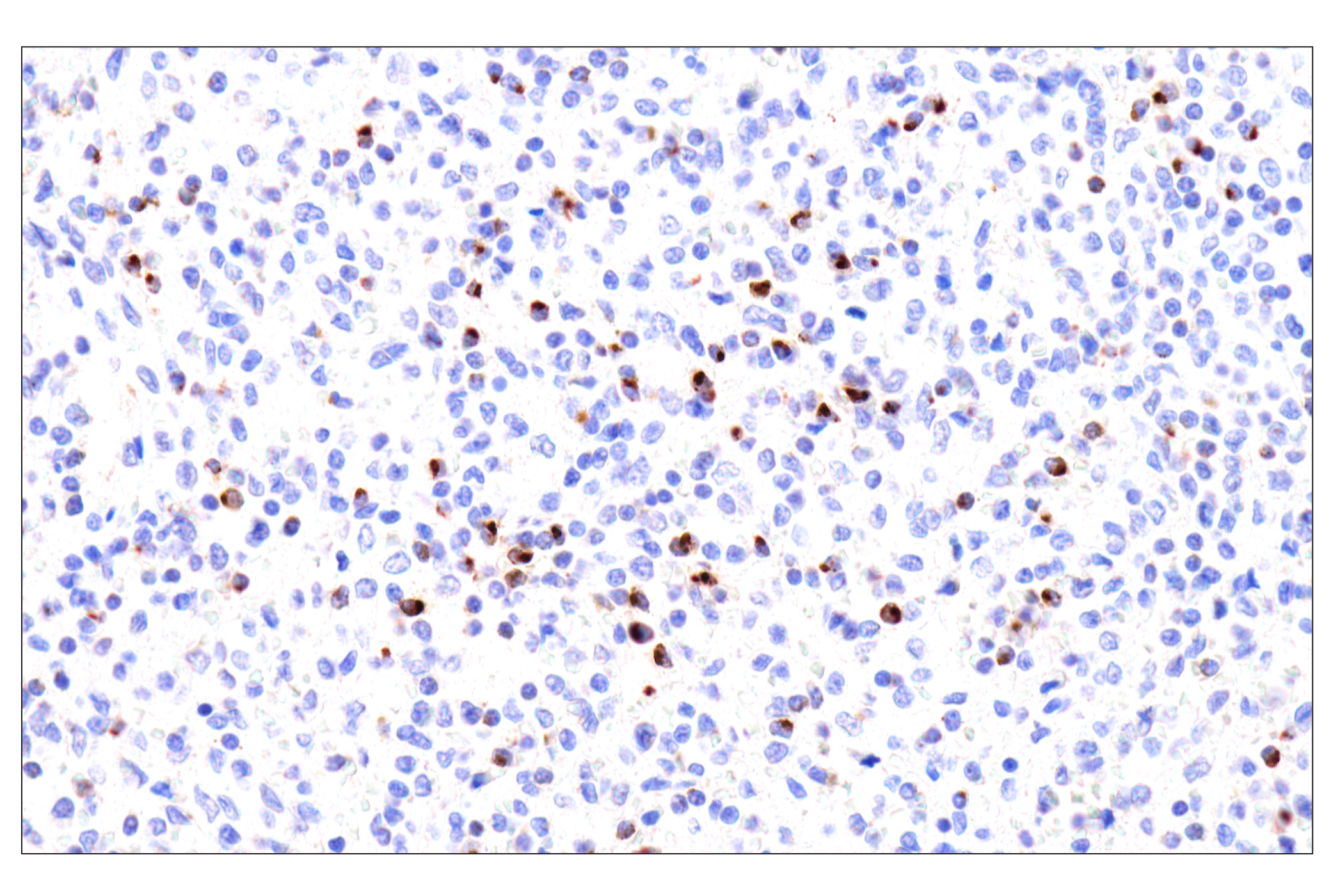 Immunohistochemistry Image 1: Perforin (IHC646) Mouse mAb