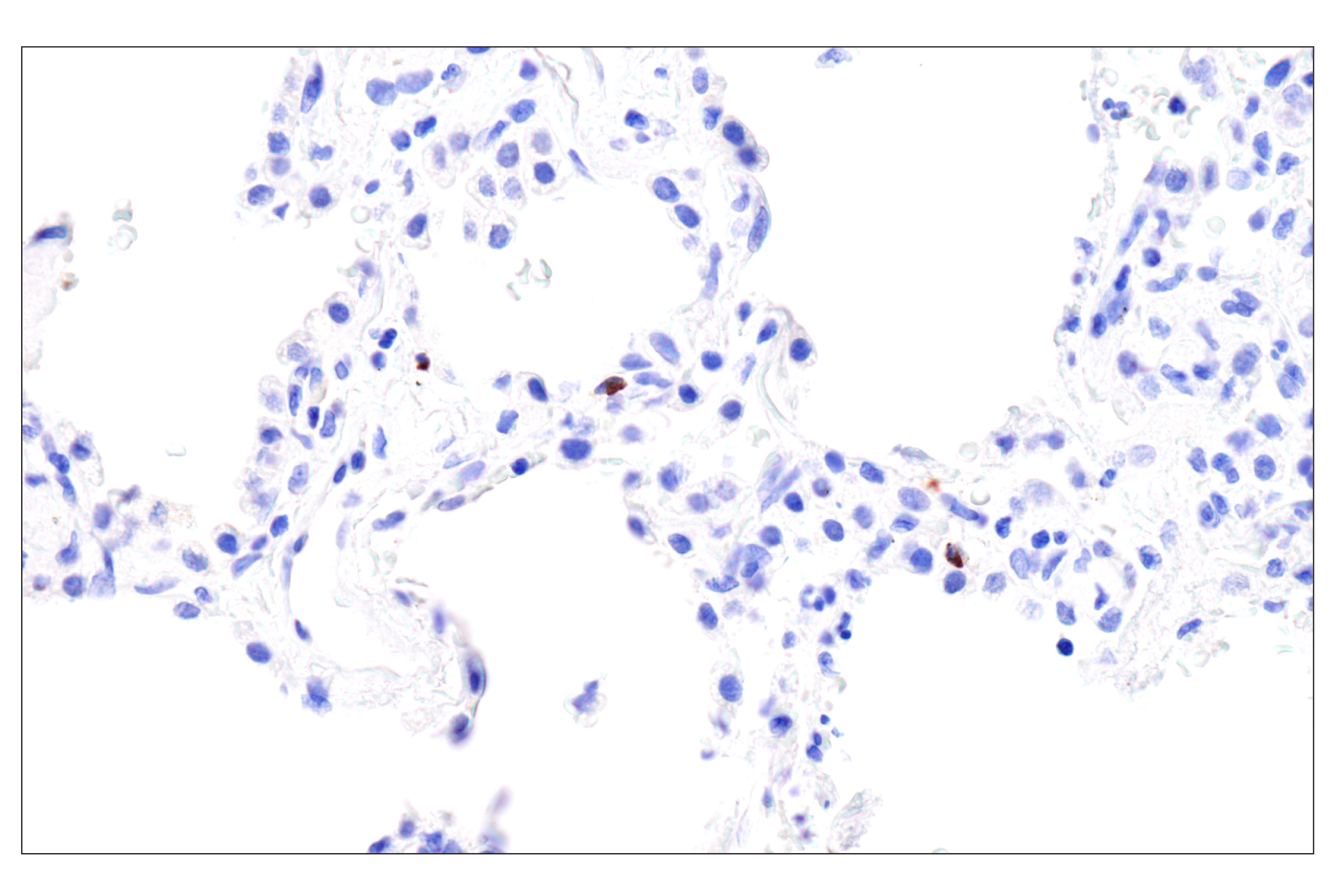 Immunohistochemistry Image 6: Perforin (IHC646) Mouse mAb