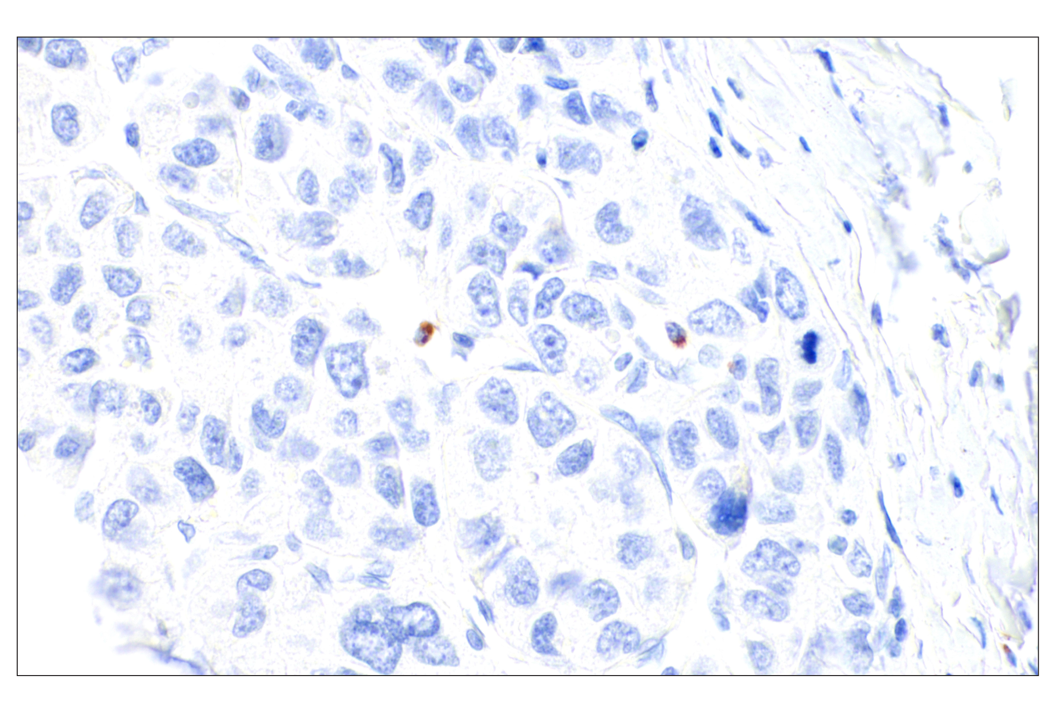Immunohistochemistry Image 5: Perforin (IHC646) Mouse mAb