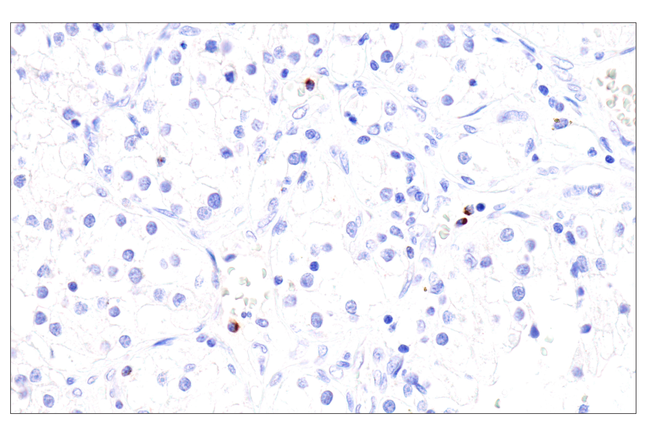 Immunohistochemistry Image 4: Perforin (IHC646) Mouse mAb