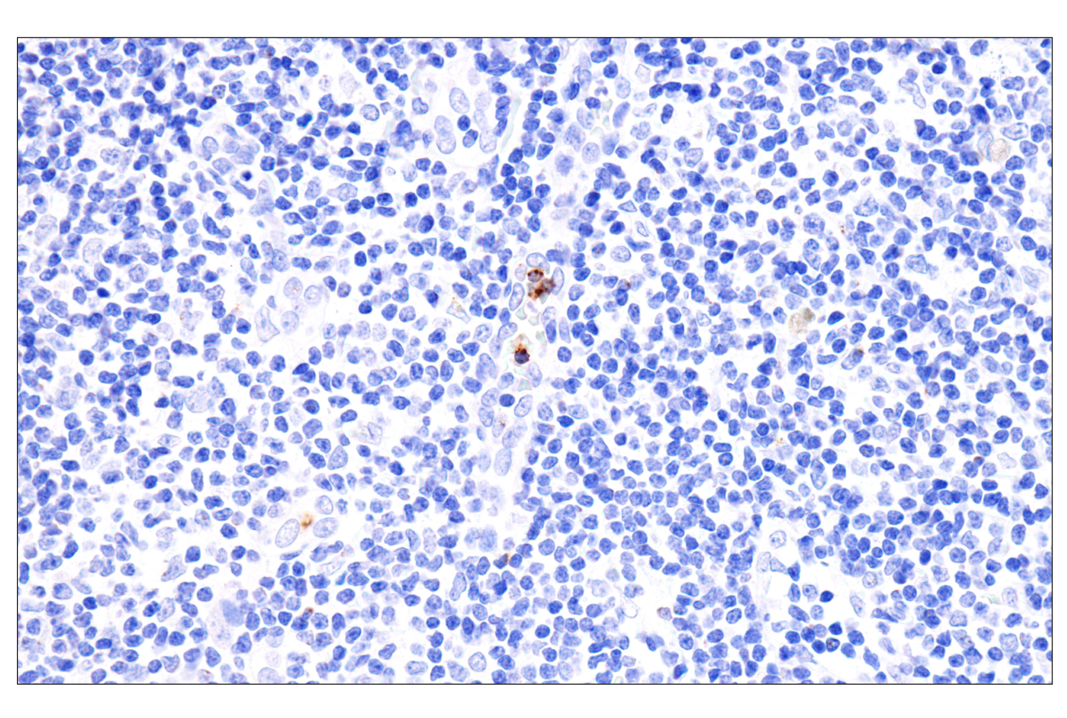 Immunohistochemistry Image 3: Perforin (IHC646) Mouse mAb