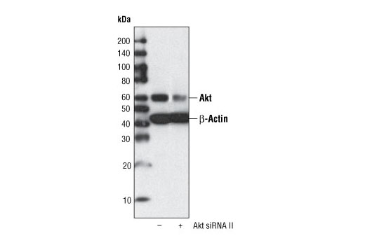 Image 1: SignalSilence® Akt siRNA II