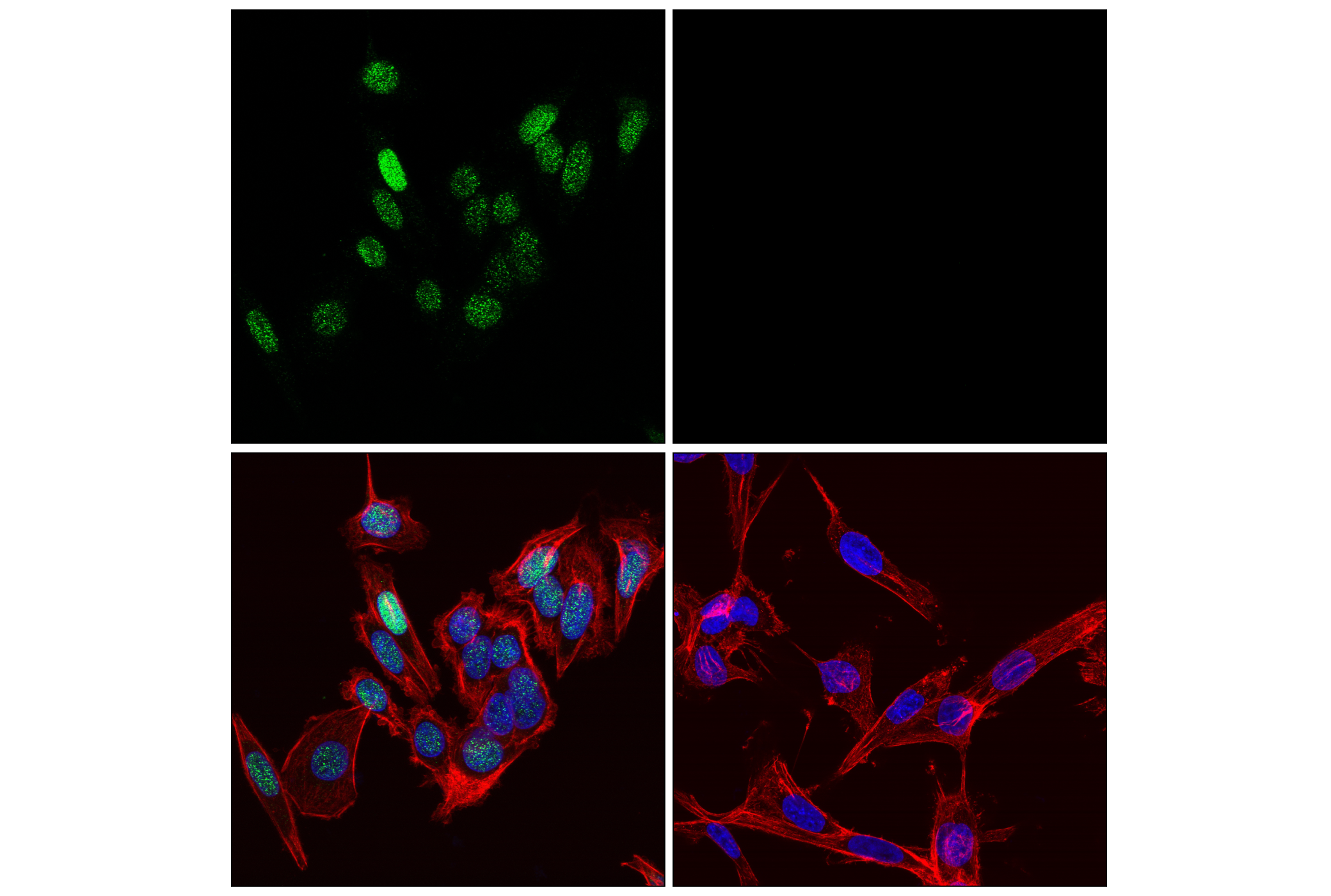 Immunofluorescence Image 1: HOXB7 (E3H4S) Rabbit mAb