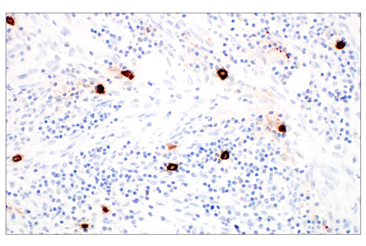 Immunohistochemistry Image 6: Tryptase (10D11) Mouse mAb