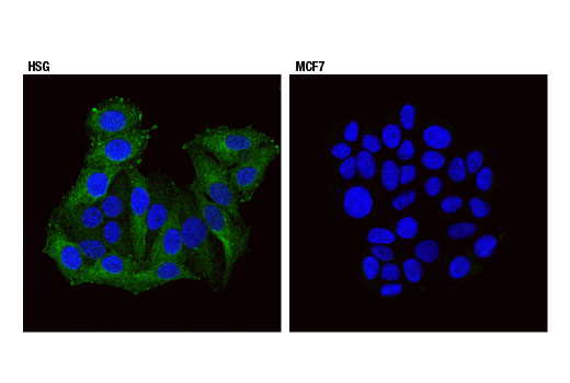 Immunofluorescence Image 1: Endophilin-1 (E1E6Q) Rabbit mAb