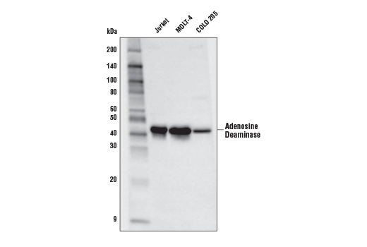 Western Blotting Image 1: Adenosine Deaminase (D1P4Y) Rabbit mAb