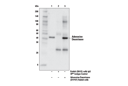 Immunoprecipitation Image 1: Adenosine Deaminase (D1P4Y) Rabbit mAb
