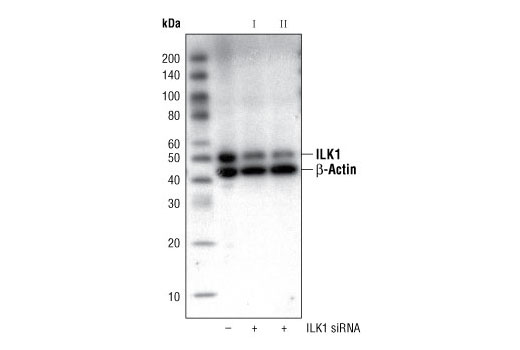  Image 1: SignalSilence® ILK1 siRNA II