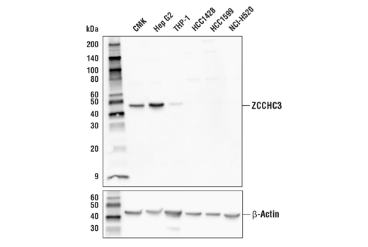 Western Blotting Image 1: ZCCHC3 Antibody