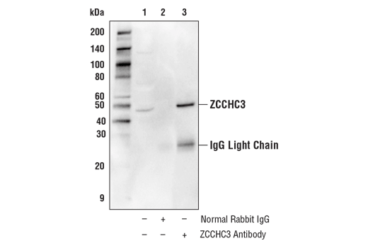 Immunoprecipitation Image 1: ZCCHC3 Antibody