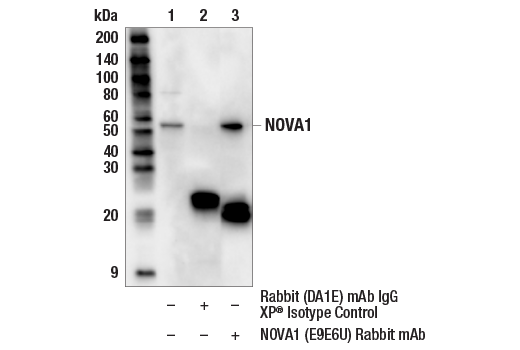 Immunoprecipitation Image 1: NOVA1 (E9E6U) Rabbit mAb