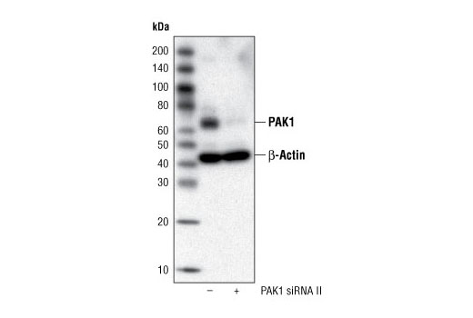  Image 1: SignalSilence® PAK1 siRNA II