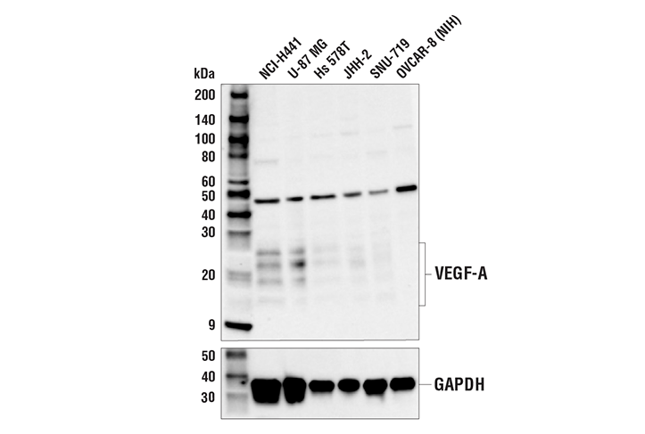  Image 6: Cancer-associated Growth Factor Antibody Sampler Kit