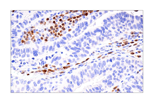 Immunohistochemistry Image 4: BOB-1/OBF-1 (E5K1D) Rabbit mAb (BSA and Azide Free)
