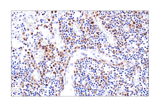 Immunohistochemistry Image 9: BOB-1/OBF-1 (E5K1D) Rabbit mAb (BSA and Azide Free)