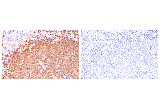 Immunohistochemistry Image 10: BOB-1/OBF-1 (E5K1D) Rabbit mAb (BSA and Azide Free)