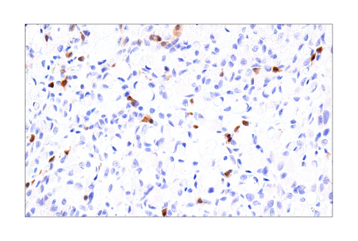 Immunohistochemistry Image 6: BOB-1/OBF-1 (E5K1D) Rabbit mAb (BSA and Azide Free)