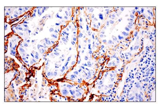 Immunohistochemistry Image 1: CD10/Neprilysin (E5P7S) Rabbit mAb