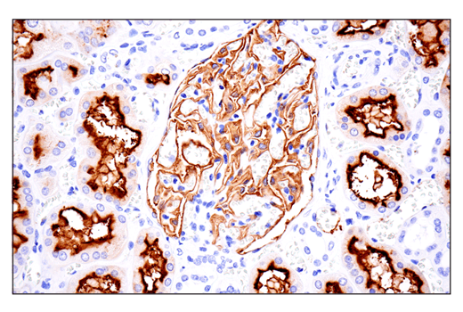 Immunohistochemistry Image 3: CD10/Neprilysin (E5P7S) Rabbit mAb