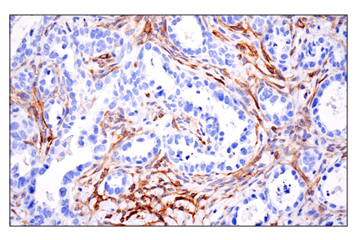 Immunohistochemistry Image 6: CD10/Neprilysin (E5P7S) Rabbit mAb
