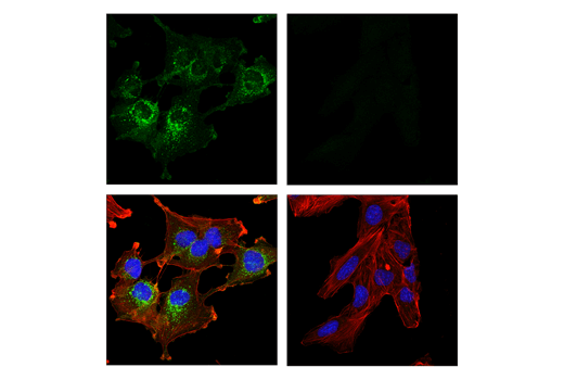 Immunofluorescence Image 1: CD10/Neprilysin (E5P7S) Rabbit mAb
