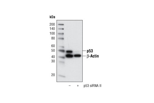  Image 1: SignalSilence® p53 siRNA II