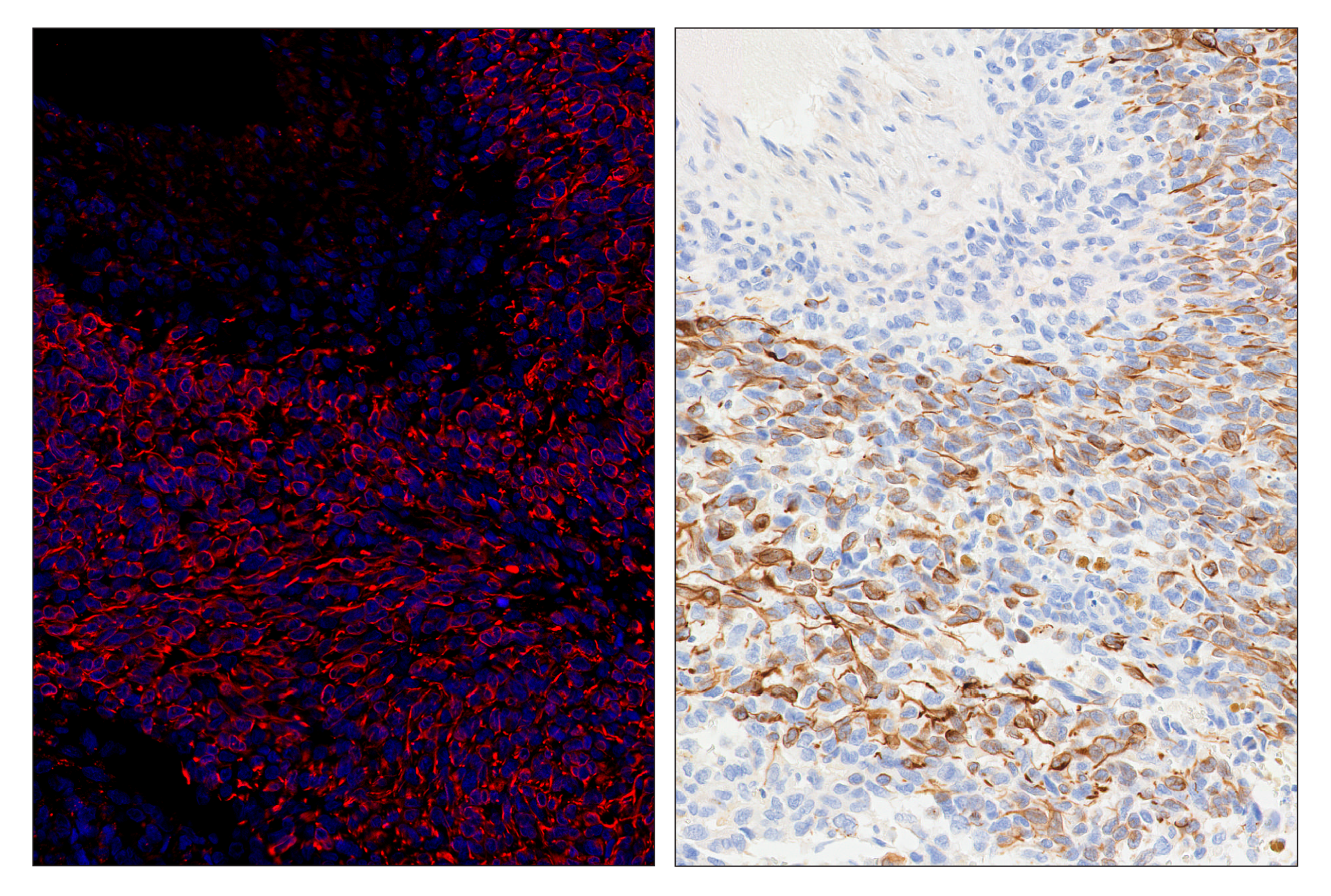 Immunohistochemistry Image 6: OX40L (D6K7R) & CO-0087-594 SignalStar™ Oligo-Antibody Pair