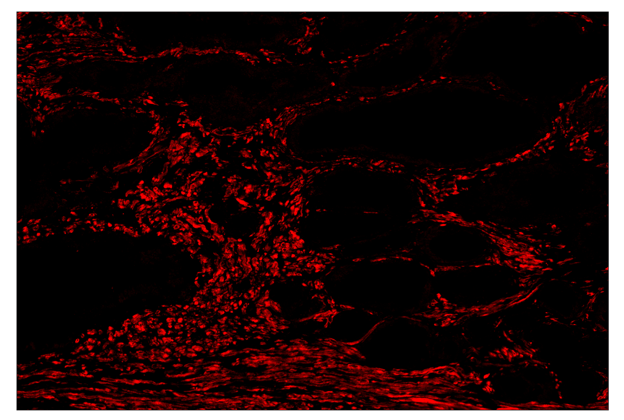 Immunohistochemistry Image 4: OX40L (D6K7R) & CO-0087-488 SignalStar™ Oligo-Antibody Pair