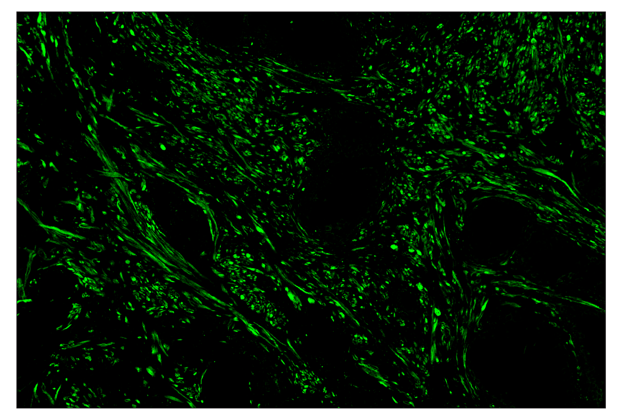 Immunohistochemistry Image 2: OX40L (D6K7R) & CO-0087-647 SignalStar™ Oligo-Antibody Pair