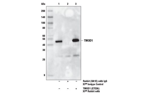 Immunoprecipitation Image 1: TMOD1 (E7E3A) XP® Rabbit mAb