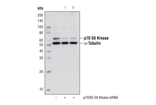  Image 1: SignalSilence® p70/85 S6 Kinase siRNA I