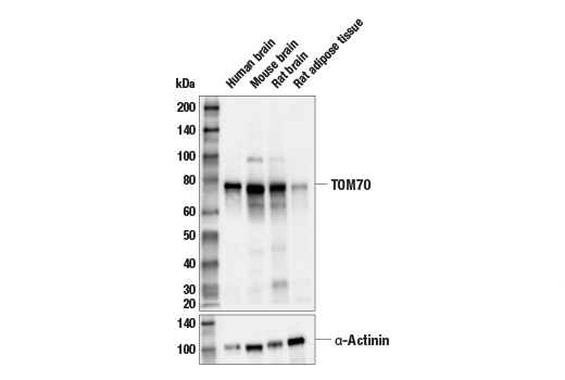 Western Blotting Image 1: TOM70 Antibody
