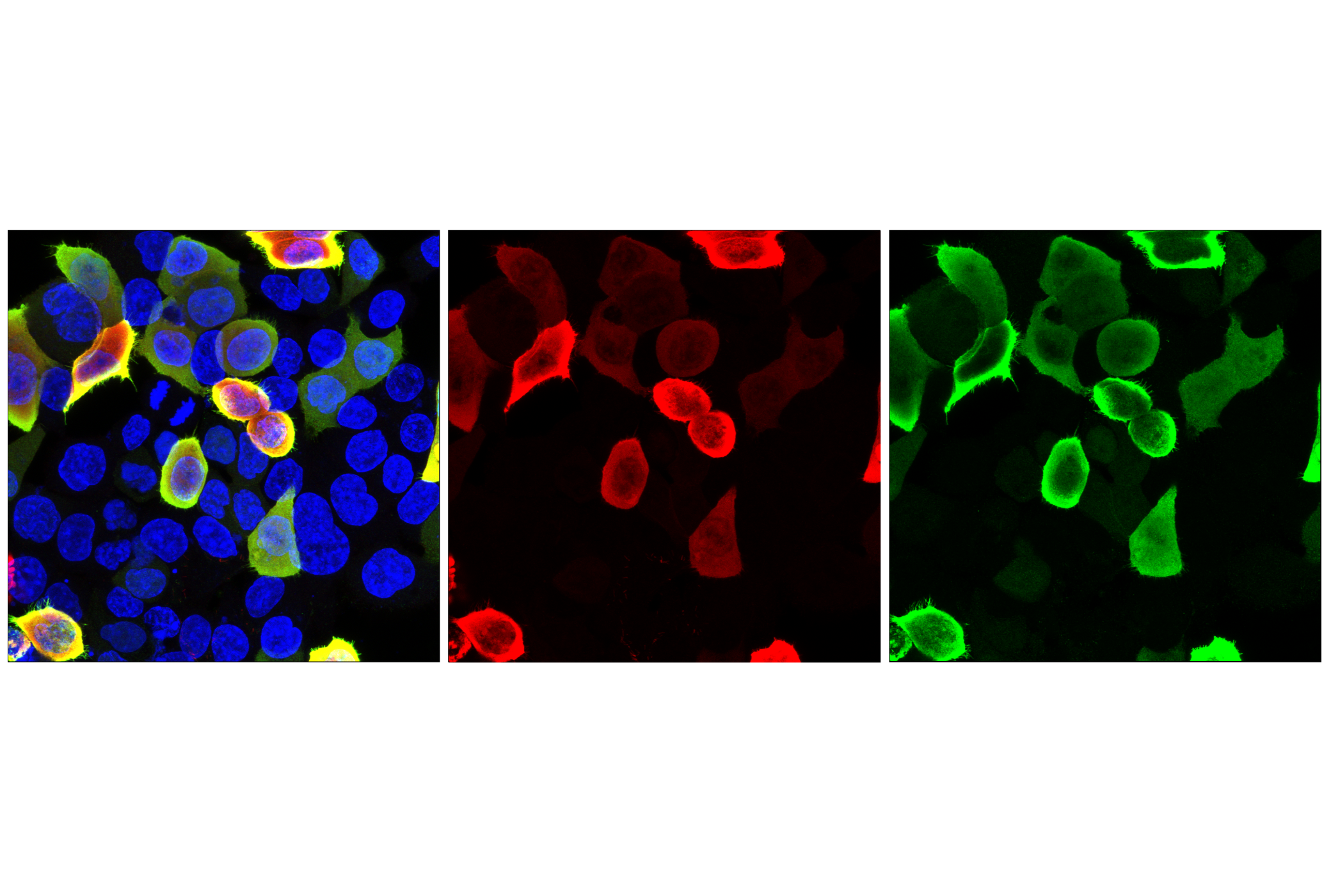 Immunofluorescence Image 1: HA-Tag (E3F8G) Mouse mAb