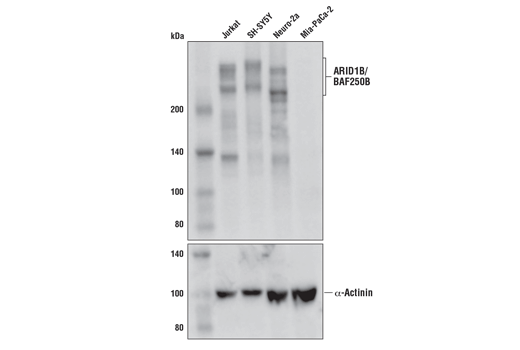  Image 8: BAF Complex IHC Antibody Sampler Kit