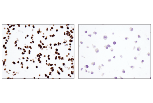 Immunohistochemistry Image 1: ARID1B/BAF250B (E1U7D) Rabbit mAb